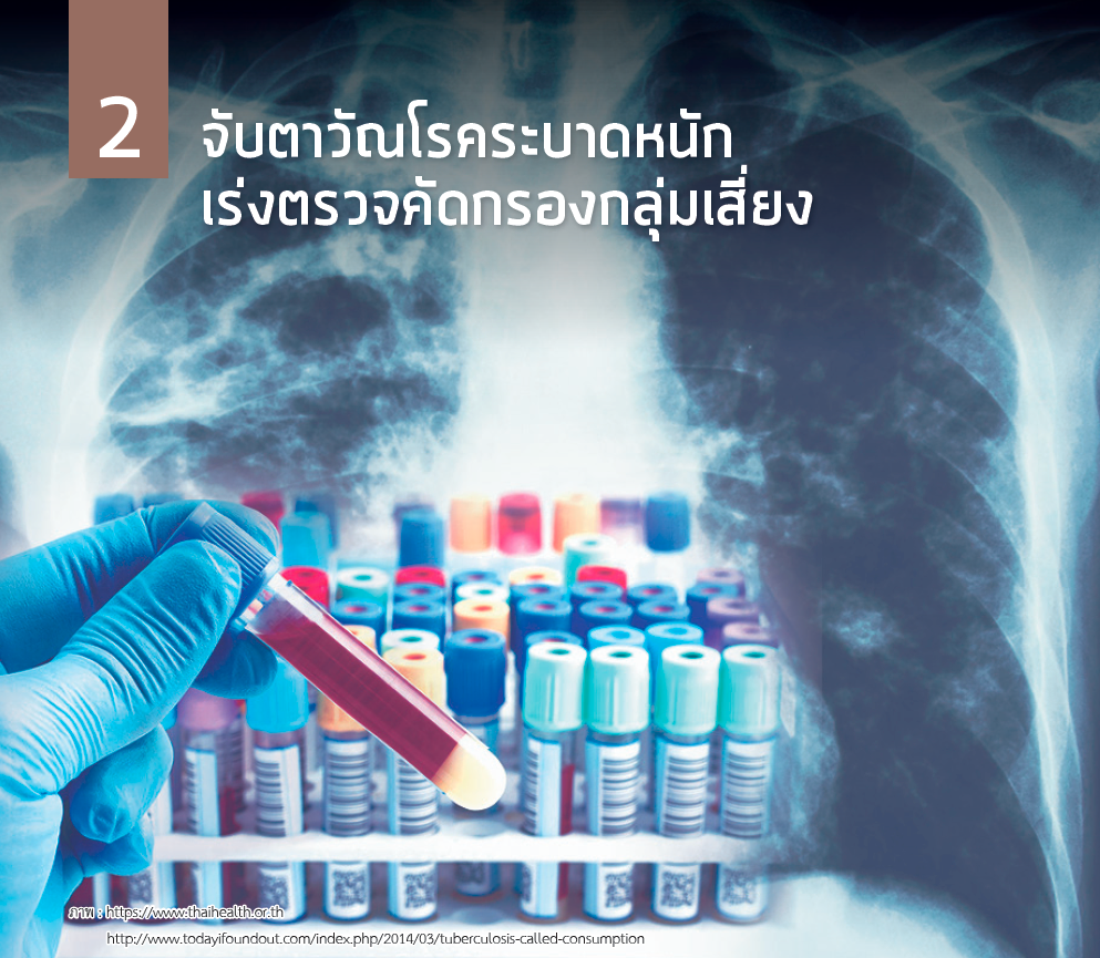 จับตาวัณโรคระบาดหนักเร่งตรวจคัดกรองกลุ่มเสี่ยง